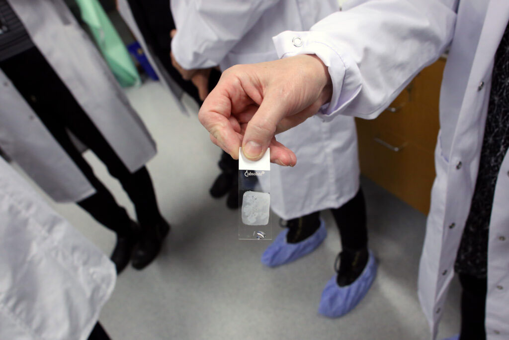 Once the tissue blocks have been dissected and placed on histolayers, the tissue can be stained with different antibodies, for example for cancer markers. The image shows an example of a mouse lung cancer blot.